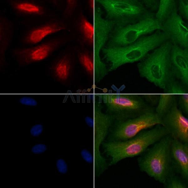 ATXN7L3 Antibody - DF9235 staining A549 cells by IF/ICC.