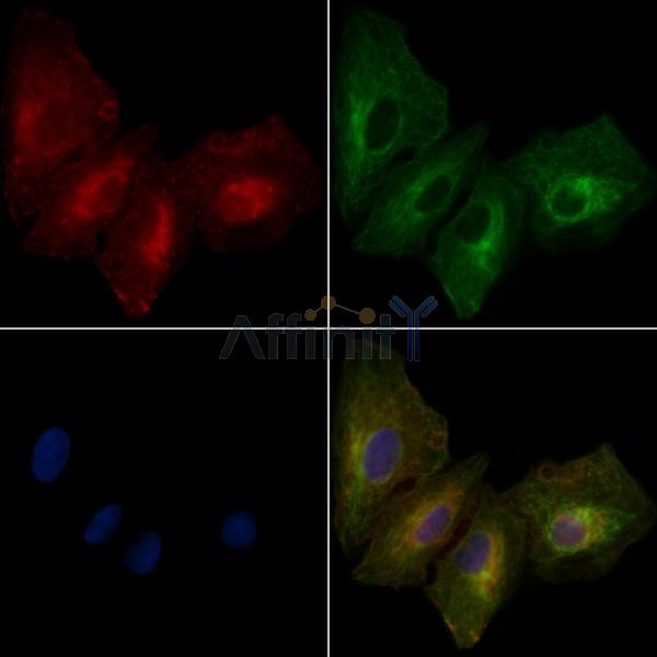 DSG3 Antibody - DF9439 staining A549 cells by IF/ICC.