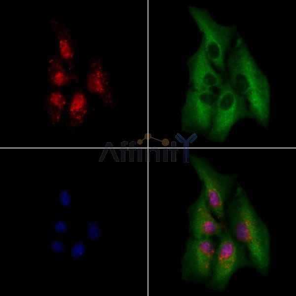 PHOX2B Antibody - DF9730 staining A549 cells by IF/ICC.