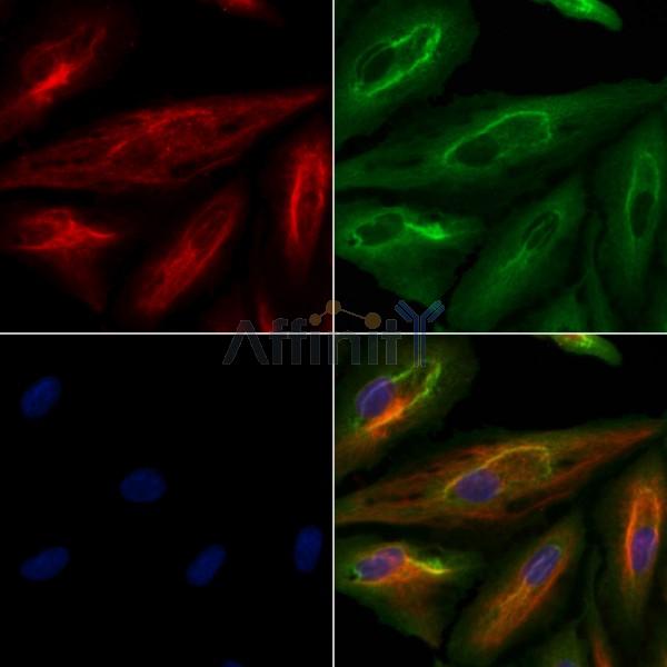 ATP2B2 Antibody - DF9757 staining A549 cells by IF/ICC.