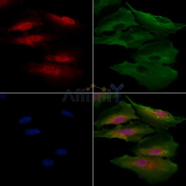 RTKN Antibody - DF9868 staining A549 cells by IF/ICC.