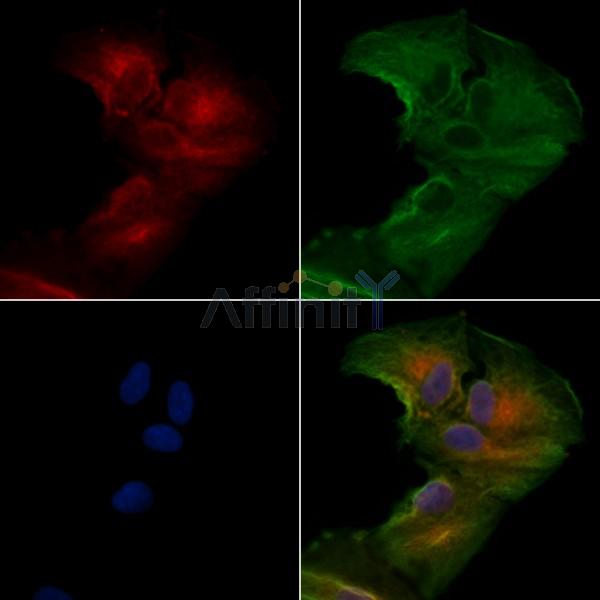SCN11A Antibody - DF9929 staining A549 cells by IF/ICC.