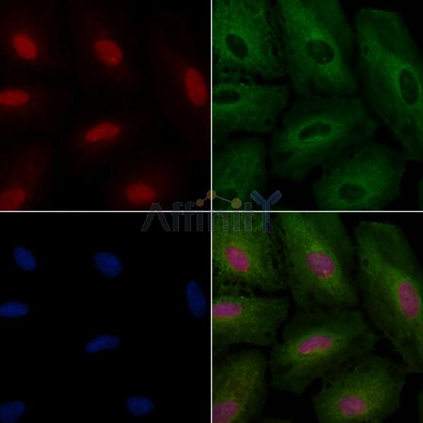 Retinoic Acid Receptor beta Antibody - AF0249 staining A549 cells by IF/ICC.