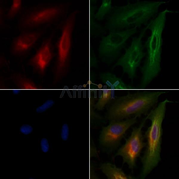 TNF Receptor I Antibody - AF0282 staining A549 cells by IF/ICC.