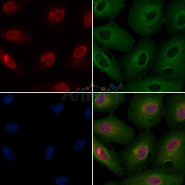 AKAP8 Antibody - AF0333 staining A549 cells by IF/ICC.