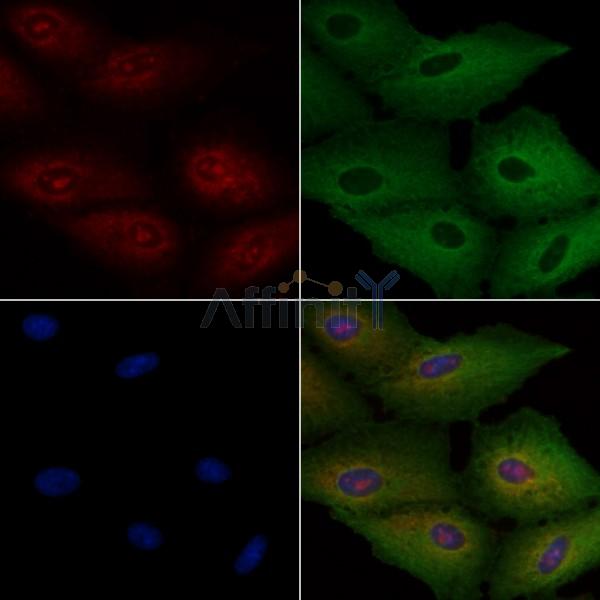 TSPAN8 Antibody - AF0362 staining A549 cells by IF/ICC.