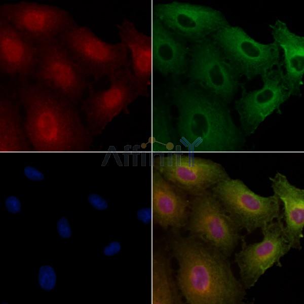 DMC1 Antibody - AF0378 staining A549 cells by IF/ICC.
