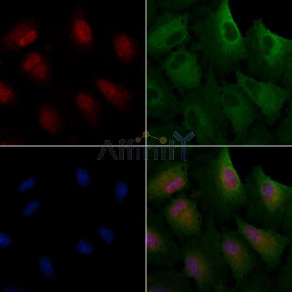USP37 Antibody - DF2259 staining A549 cells by IF/ICC.