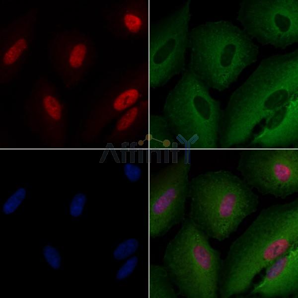 MSH3 Antibody - DF2385 staining A549 cells by IF/ICC.
