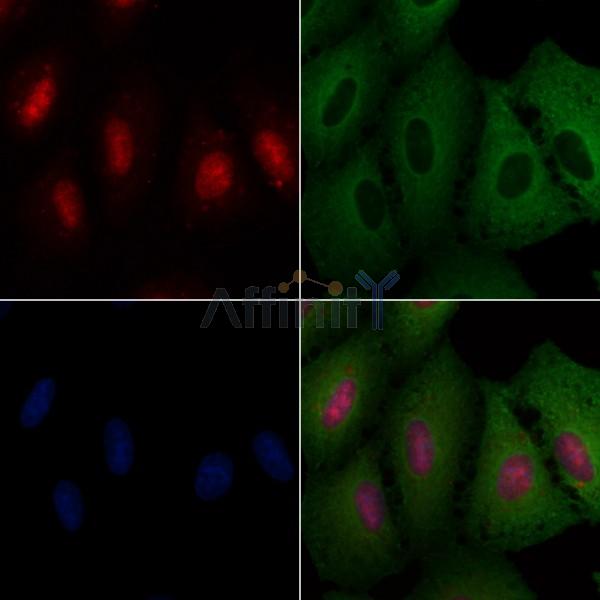 ZNF750 Antibody - DF2397 staining A549 cells by IF/ICC.