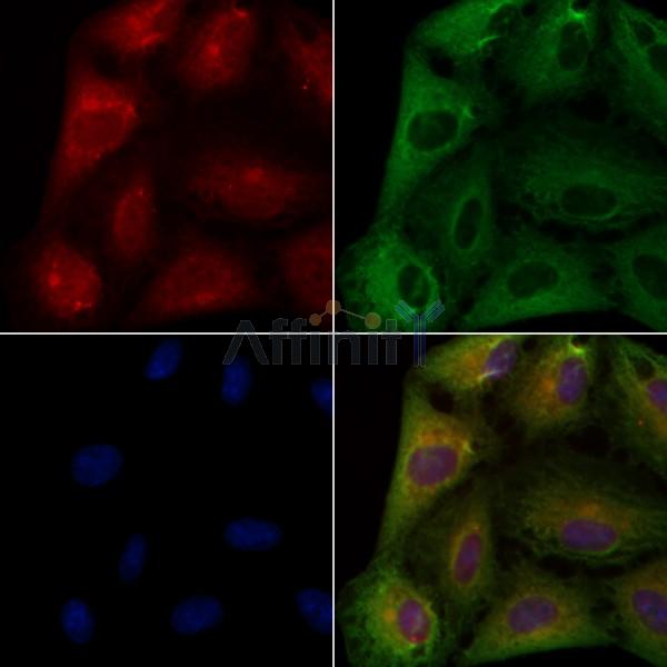 TACD2 Antibody - DF3080 staining A549 cells by IF/ICC.