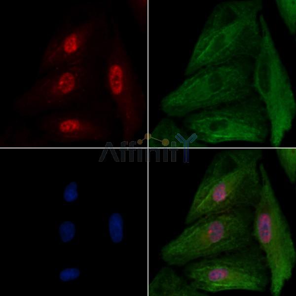 NR2F6 Antibody - DF3085 staining A549 cells by IF/ICC.