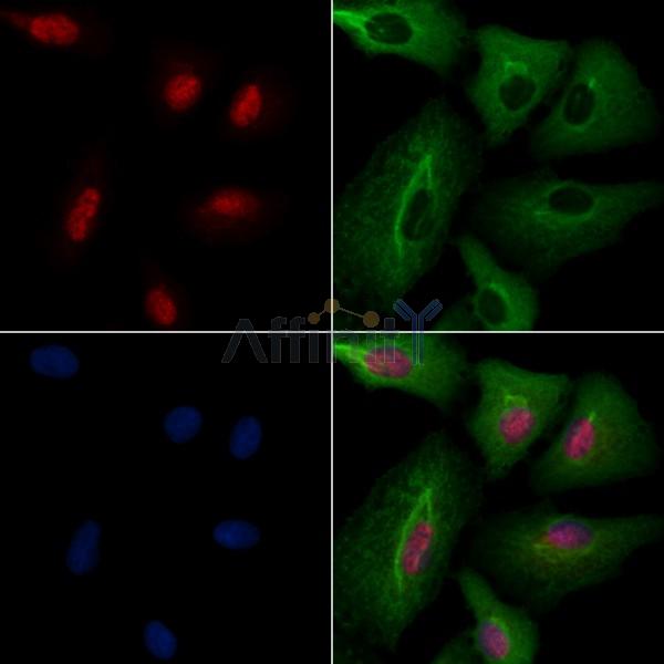 CLK2 Antibody - DF3190 staining A549 cells by IF/ICC.