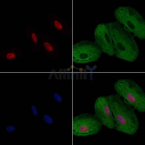 hnRNP F Antibody - DF3204 staining A549 cells by IF/ICC.