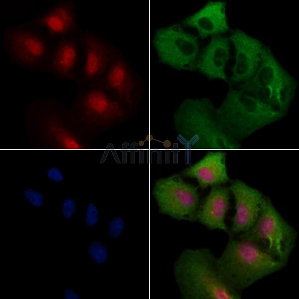 COPS2 Antibody - DF3222 staining A549 cells by IF/ICC.