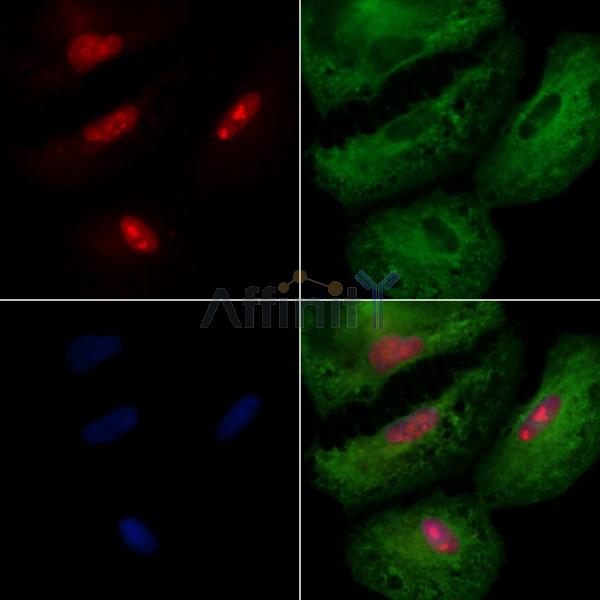 IRX1 Antibody - DF3225 staining A549 cells by IF/ICC.