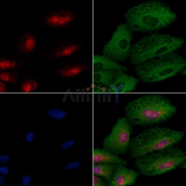 GTF3C2 Antibody - DF3372 staining A549 cells by IF/ICC.