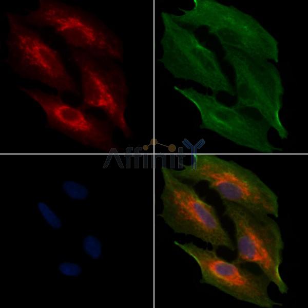 MRPL11 Antibody - DF3656 staining A549 cells by IF/ICC.