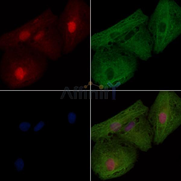 ARL2BP Antibody - DF3749 staining A549 cells by IF/ICC.