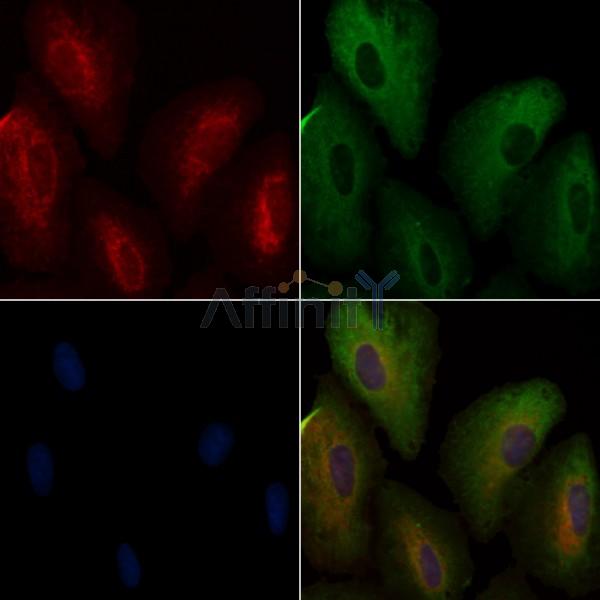 ATXN2L Antibody - DF3800 staining A549 cells by IF/ICC.