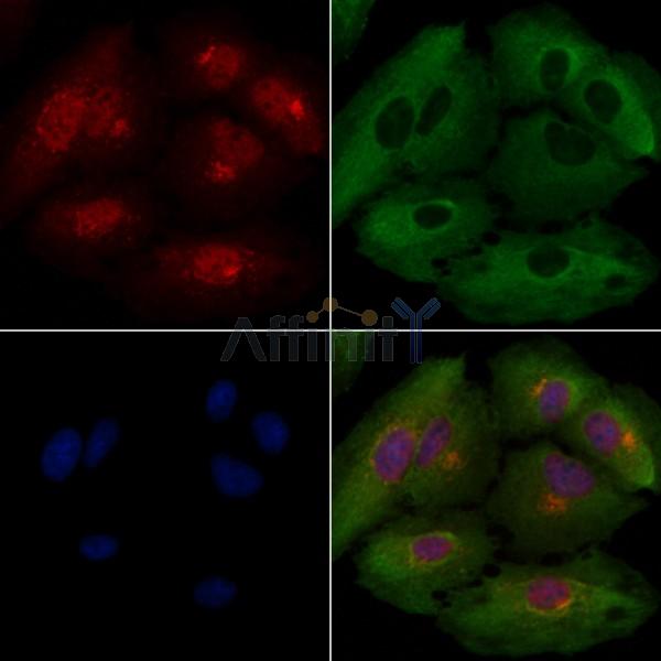 CNN2 Antibody - DF3870 staining A549 cells by IF/ICC.