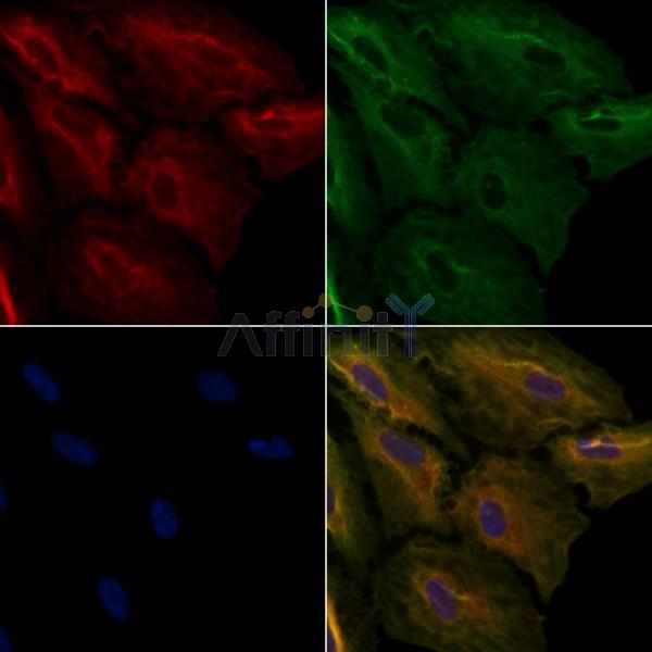 CAGE1 Antibody - DF3875 staining A549 cells by IF/ICC.