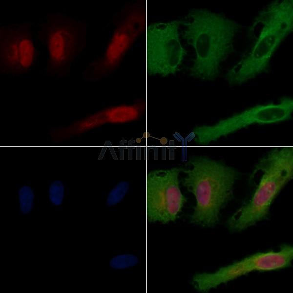 RNF111 Antibody - DF4015 staining A549 cells by IF/ICC.