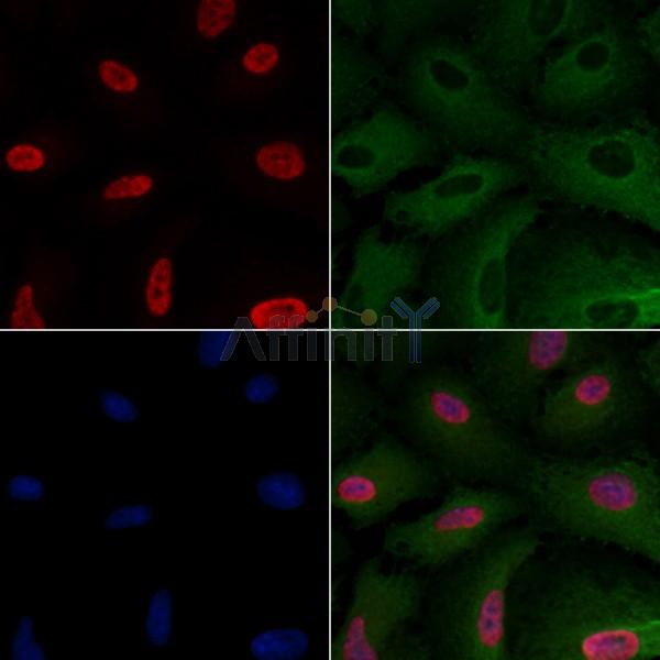 LRRC41 Antibody - DF4138 staining A549 cells by IF/ICC.