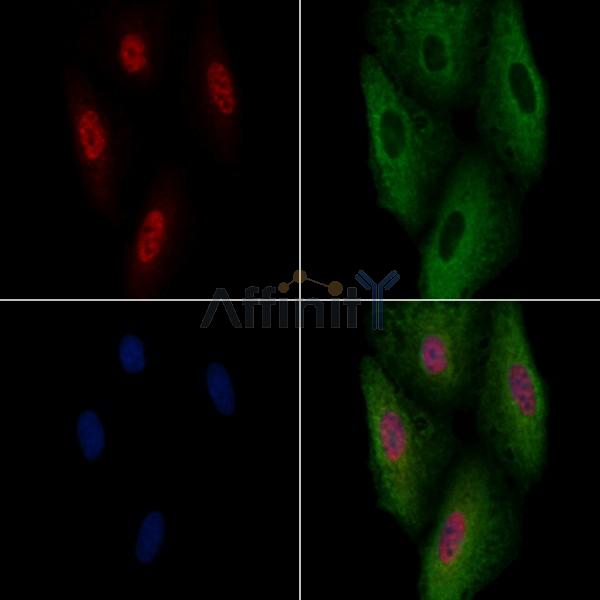 MDFI Antibody - DF4193 staining A549 cells by IF/ICC.