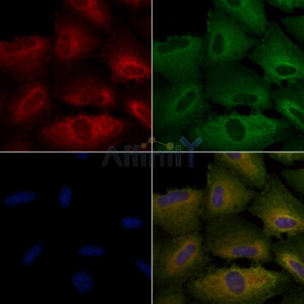 NOX5 Antibody - DF4219 staining A549 cells by IF/ICC.