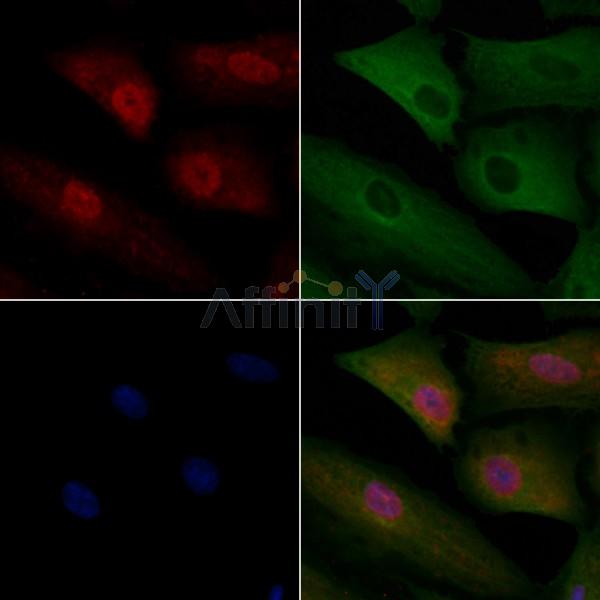 UBAP2L Antibody - DF4599 staining A549 cells by IF/ICC.