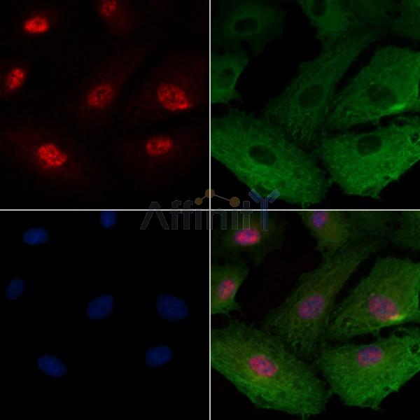 ZSCAN22 Antibody - DF4621 staining A549 cells by IF/ICC.