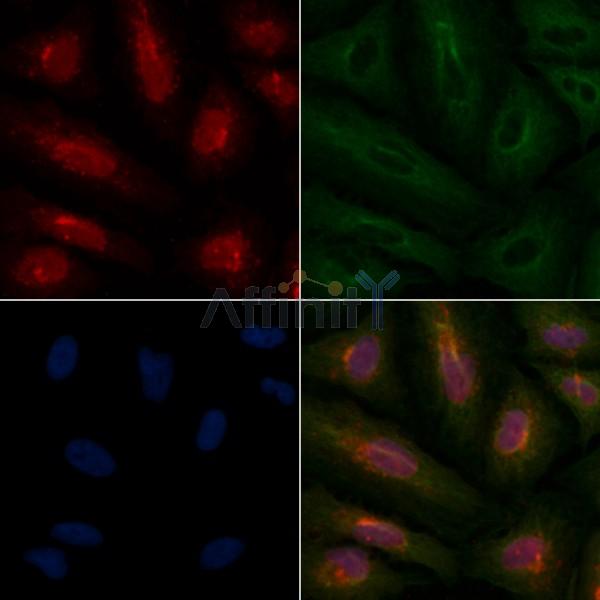 Rad51C Antibody - DF4644 staining A549 cells by IF/ICC.