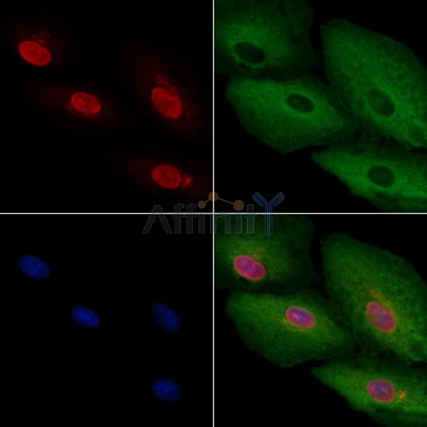 ARX Antibody - DF4674 staining A549 cells by IF/ICC.