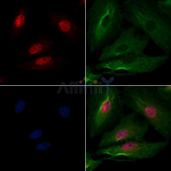CHFR Antibody - DF4733 staining A549 cells by IF/ICC.