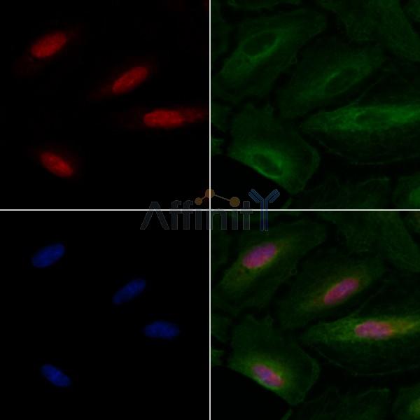 GATA6 Antibody - DF4736 staining A549 cells by IF/ICC.