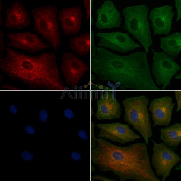 VN1R2 Antibody - DF5174 staining A549 cells by IF/ICC.