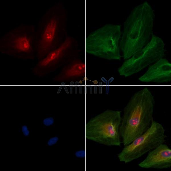 OR8B4 Antibody - DF5207 staining A549 cells by IF/ICC.