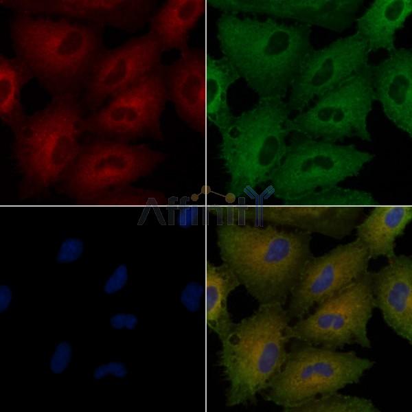 RNASE12 Antibody - DF6217 staining A549 cells by IF/ICC.