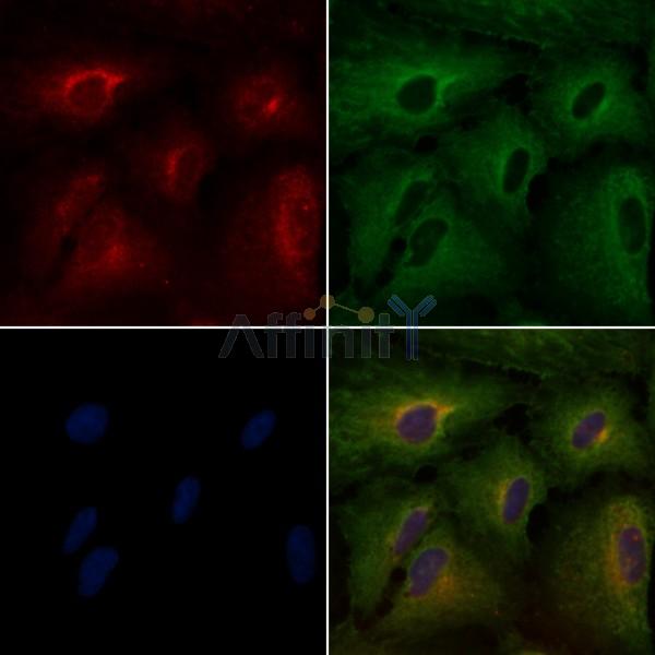 SPINK1 Antibody - DF6239 staining A549 cells by IF/ICC.