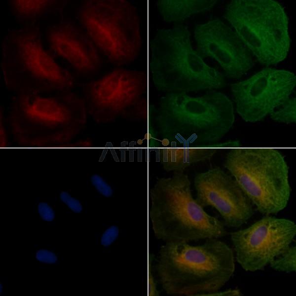 LDHA Antibody - DF6280 staining A549 cells by IF/ICC.