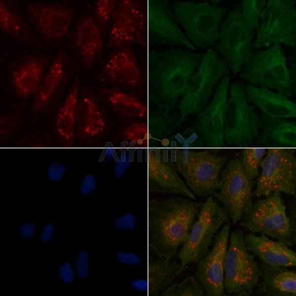 PROS1 Antibody - DF6487 staining A549 cells by IF/ICC.
