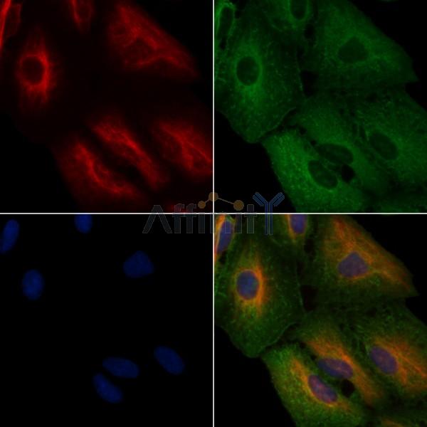 HMGCR Antibody - DF6518 staining A549 cells by IF/ICC.