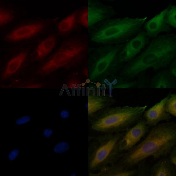 CD151 Antibody - DF6699 staining A549 cells by IF/ICC.