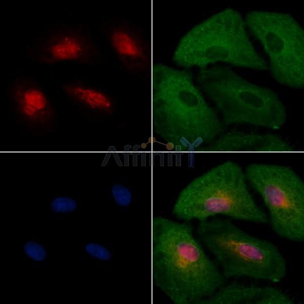 NDC80 Antibody - DF7329 staining A549 cells by IF/ICC.