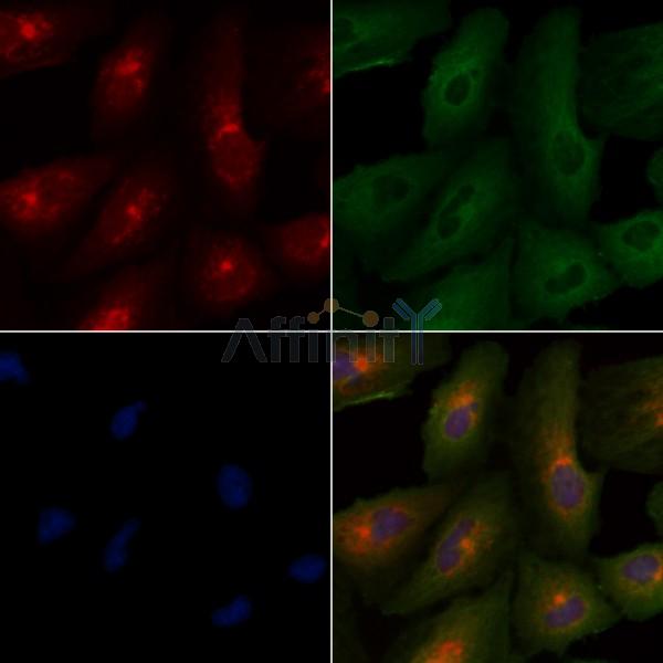 GAP43 Antibody - DF7766 staining A549 cells by IF/ICC.