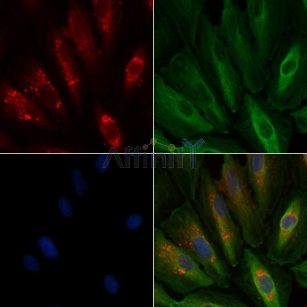 APOD Antibody - DF7987 staining A549 cells by IF/ICC.