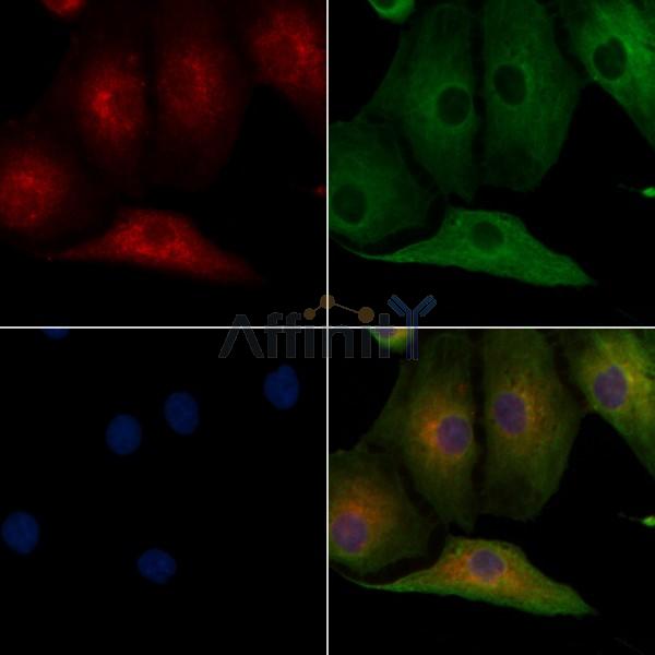 CASQ2 Antibody - DF8008 staining A549 cells by IF/ICC.