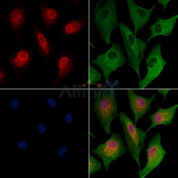 RBBP7 Antibody - DF8024 staining A549 cells by IF/ICC.