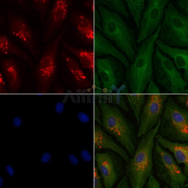 KATNA1 Antibody - DF8027 staining A549 cells by IF/ICC.